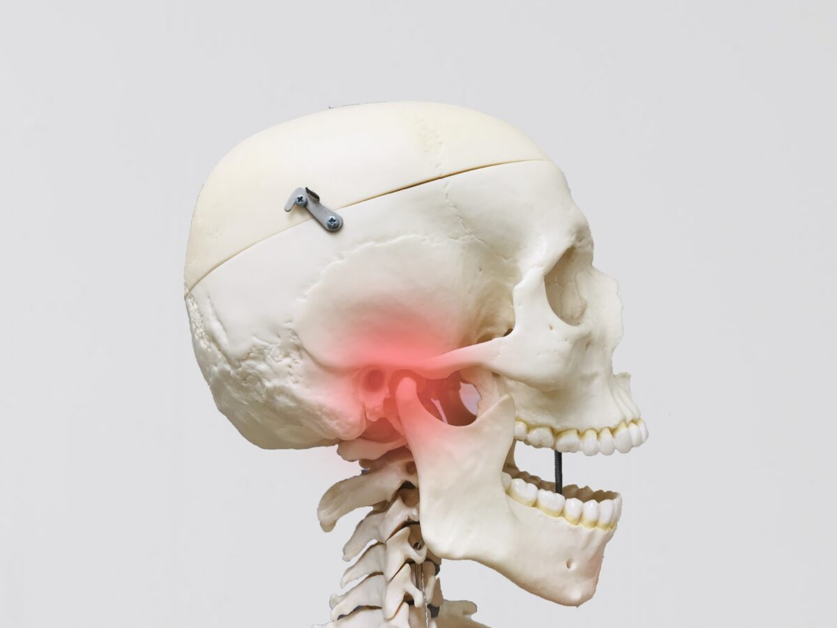 顎関節症の説明のための頭蓋骨模型