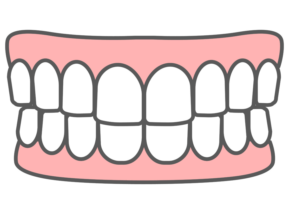 正常な歯並びの歯と歯茎の図