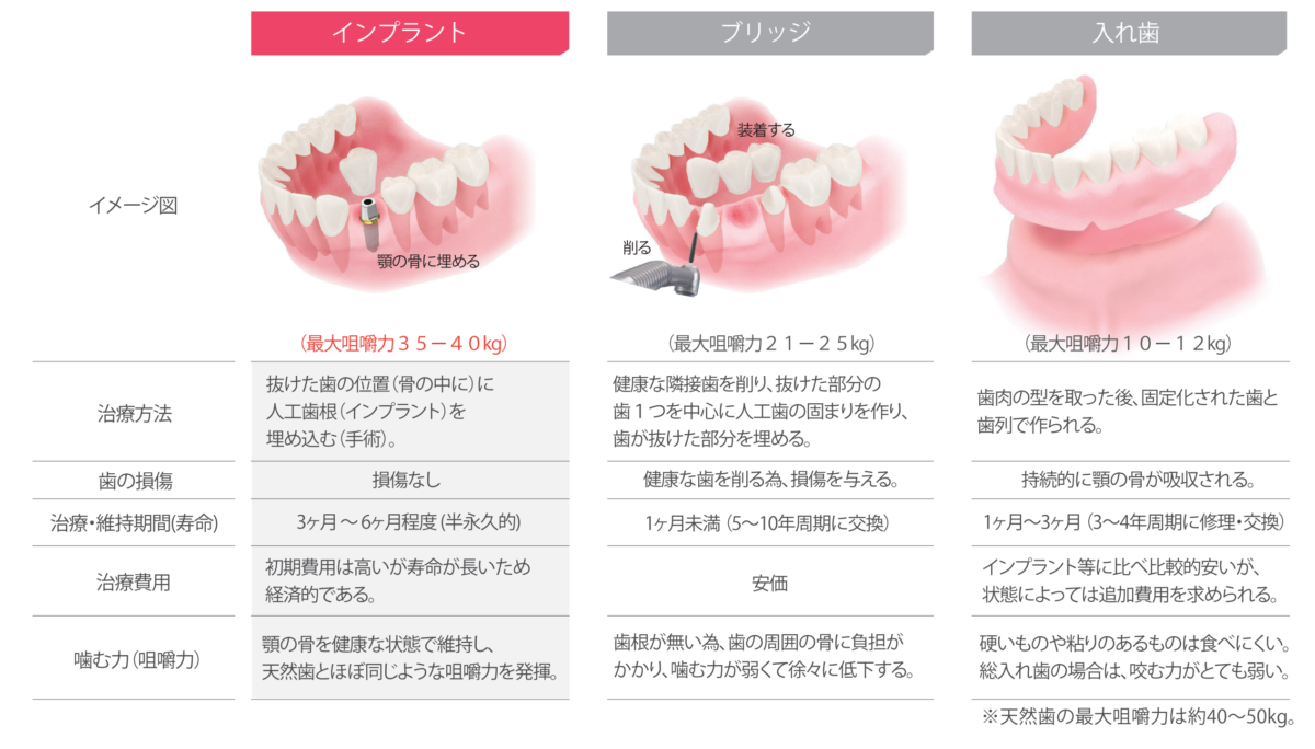 インプラント治療とブリッジ治療と入れ歯治療の比較